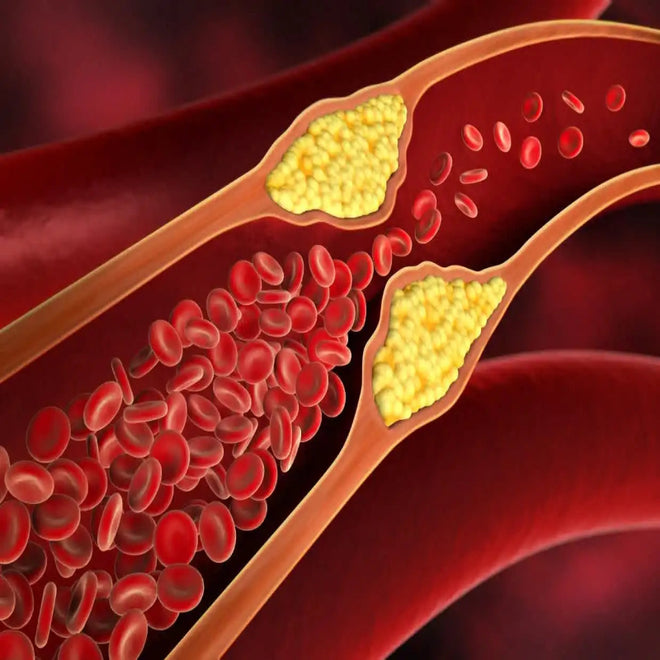Cholesterol Support
